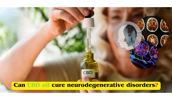 Can CBD Oil Cure Neurodegenerative Disorders?