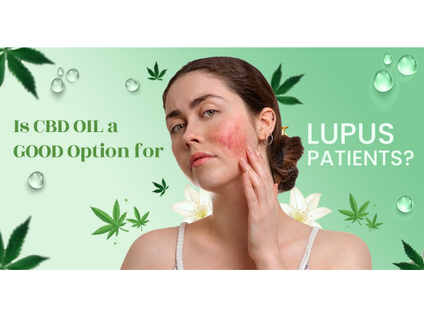 Lupus Patients