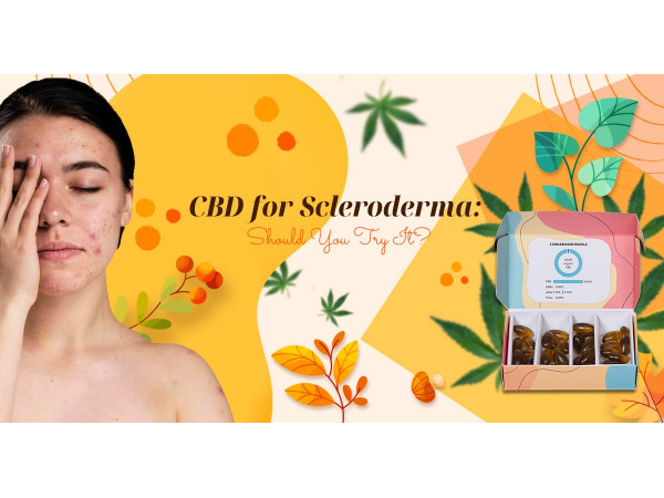 Cbd for Scleroderma